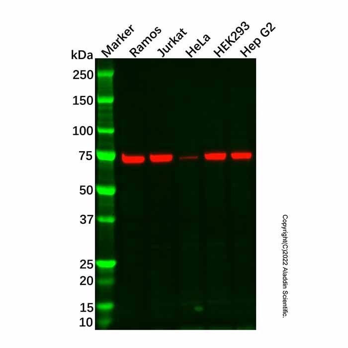Recombinant SLC22A1/OCT1 Antibody -    by Aladdin Scientific