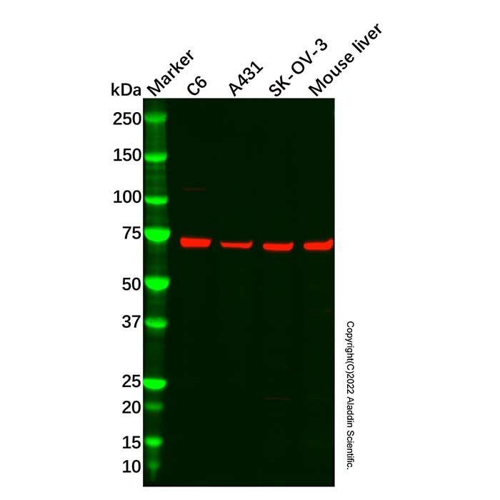Recombinant SLC25A12 Antibody -    by Aladdin Scientific