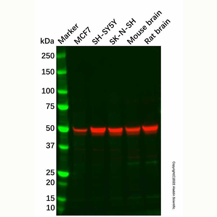 SLC29A4/PMAT Antibody -    by Aladdin Scientific