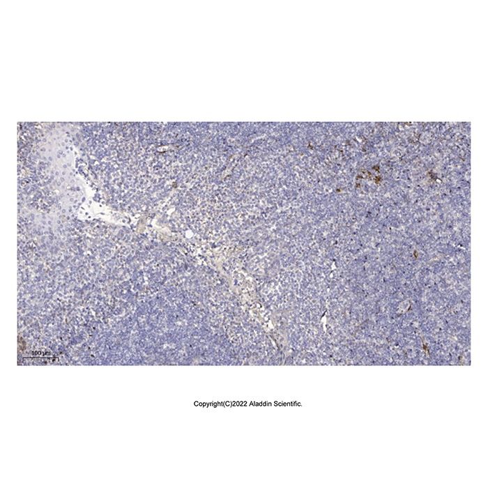 SLC6A8 Antibody -    by Aladdin Scientific