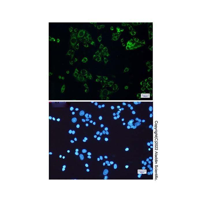 Recombinant SLP-2 Antibody -    by Aladdin Scientific