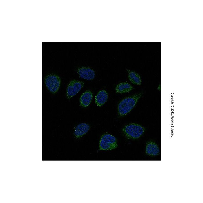 Recombinant Smad2 Antibody -    by Aladdin Scientific