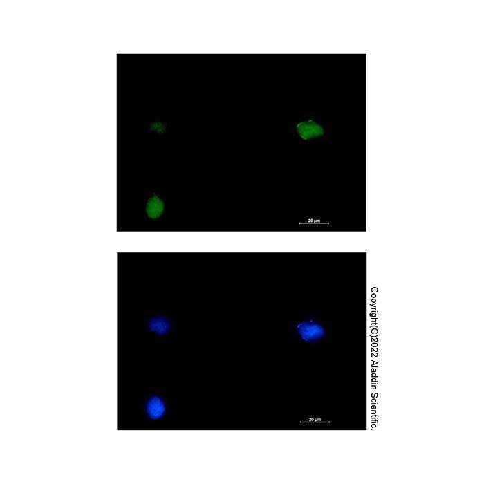 Recombinant SMARCC1/BAF155 Antibody -    by Aladdin Scientific