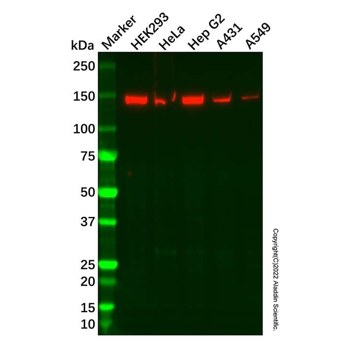 SMC2 Antibody -    by Aladdin Scientific