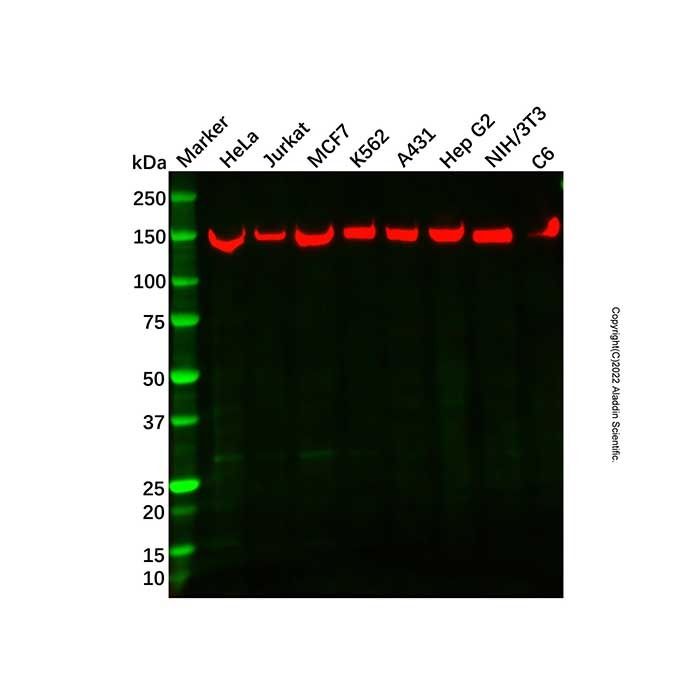 Recombinant SMC3 Antibody -    by Aladdin Scientific