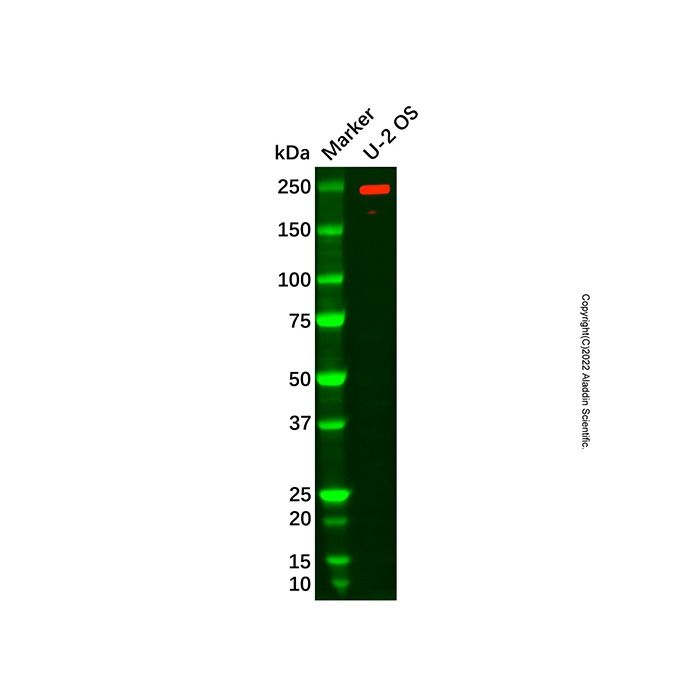 Recombinant SMCHD1 Antibody -    by Aladdin Scientific