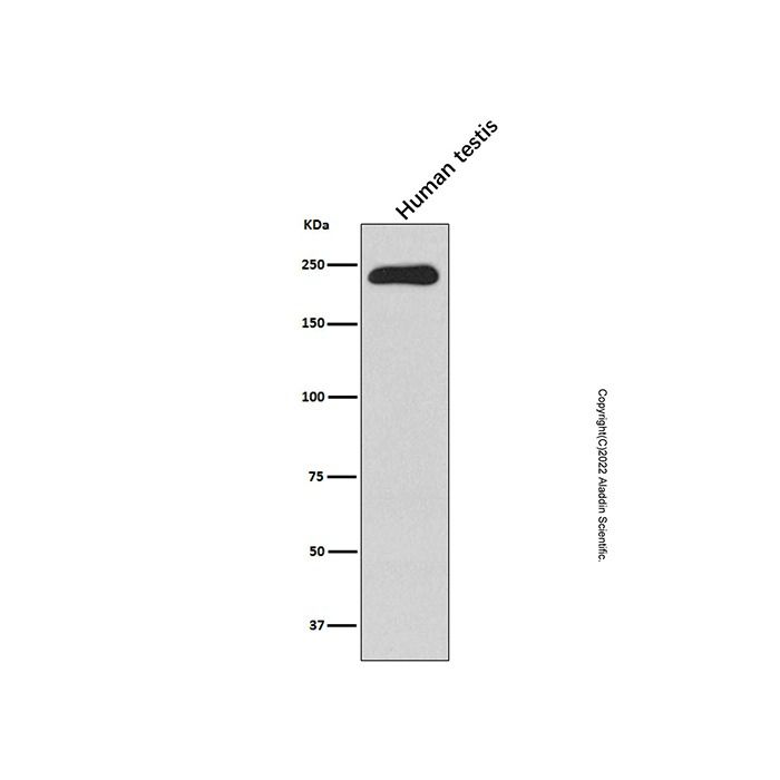 Recombinant smooth muscle Myosin heavy chain 11 Antibody -    by Aladdin Scientific