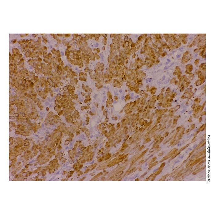 Recombinant smooth muscle Myosin heavy chain 11 Antibody -    by Aladdin Scientific