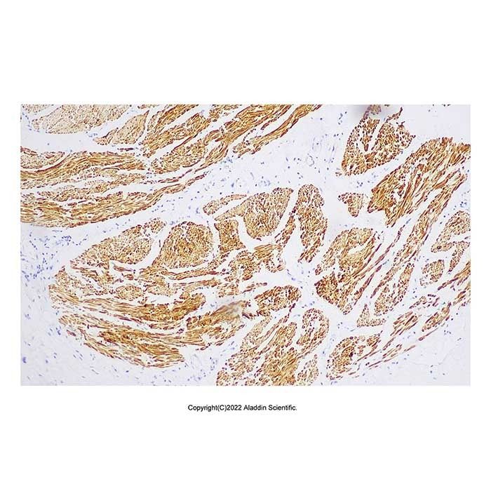 Recombinant Smoothelin Antibody -    by Aladdin Scientific