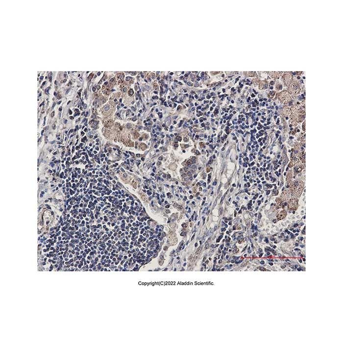 Recombinant SMYD3 Antibody -    by Aladdin Scientific