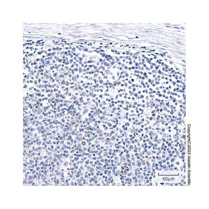 Recombinant SNF5/SMARCB1 Antibody -    by Aladdin Scientific