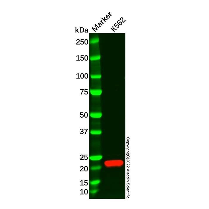 Recombinant SOCS2 Antibody -    by Aladdin Scientific