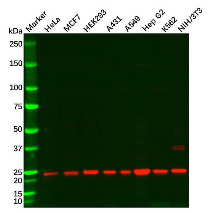 SOD2/MnSOD Antibody -    by Aladdin Scientific