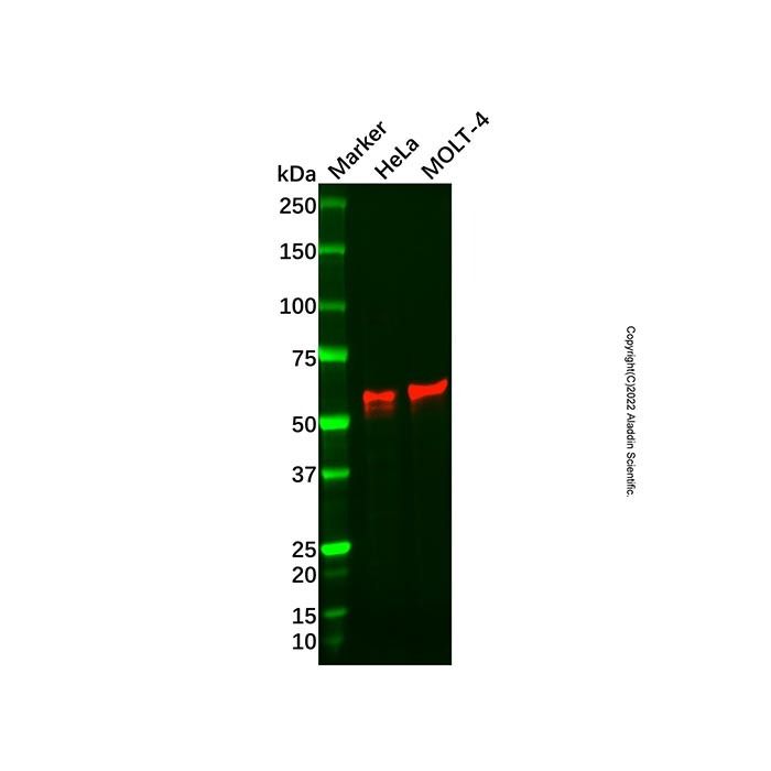 Recombinant SODD Antibody -    by Aladdin Scientific