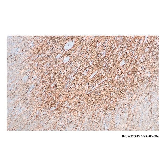 Recombinant Somatostatin Receptor 2 Antibody -    by Aladdin Scientific