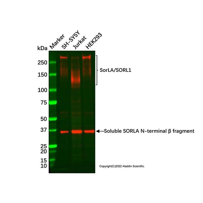 Recombinant SorLA/SORL1 Antibody -    by Aladdin Scientific