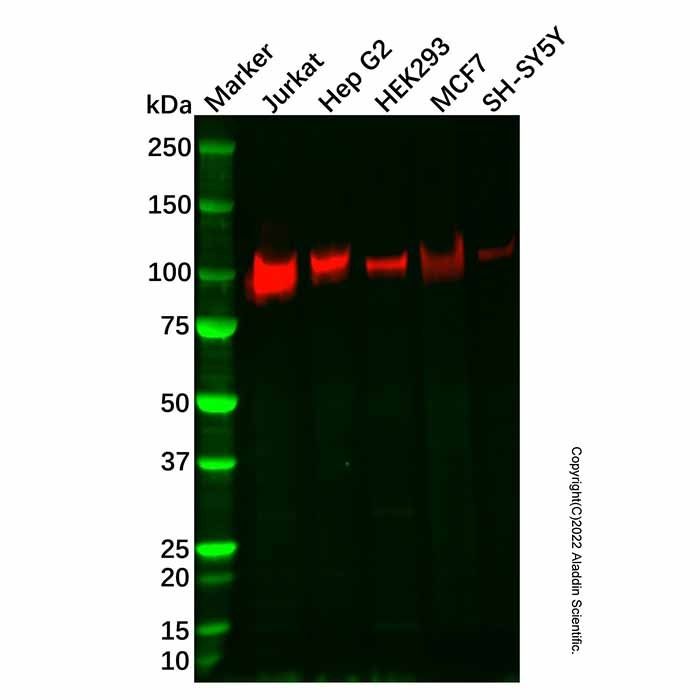Recombinant Sortilin/NT3 Antibody -    by Aladdin Scientific