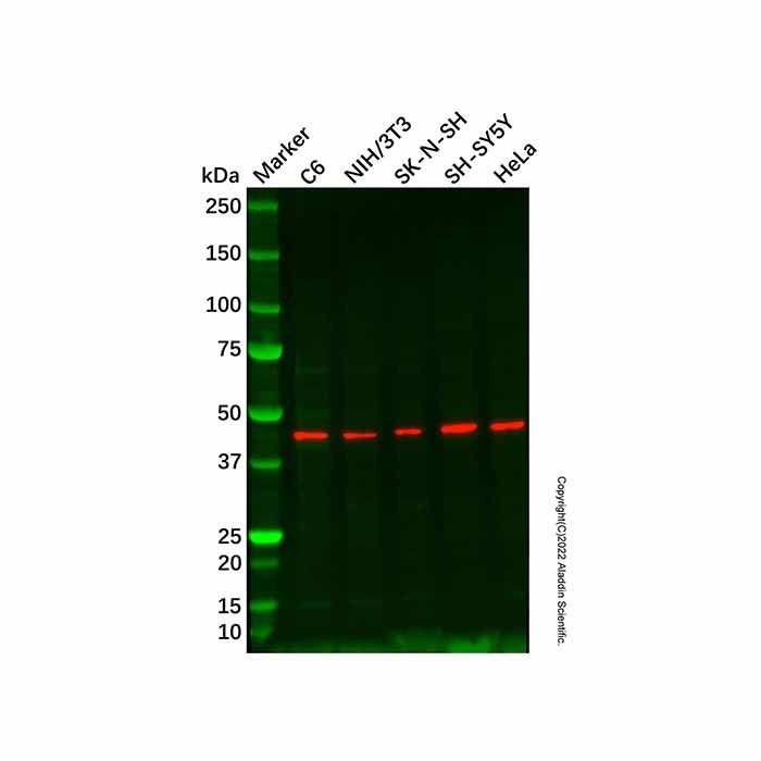 Recombinant SOX1 Antibody -    by Aladdin Scientific