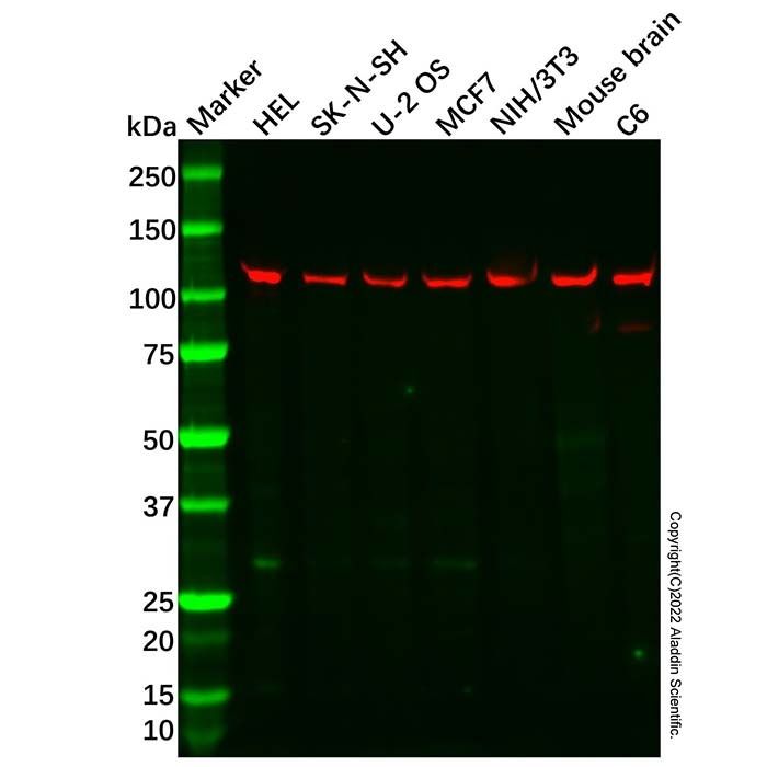 Spinophilin/Neurabin 2 Mouse mAb -    by Aladdin Scientific
