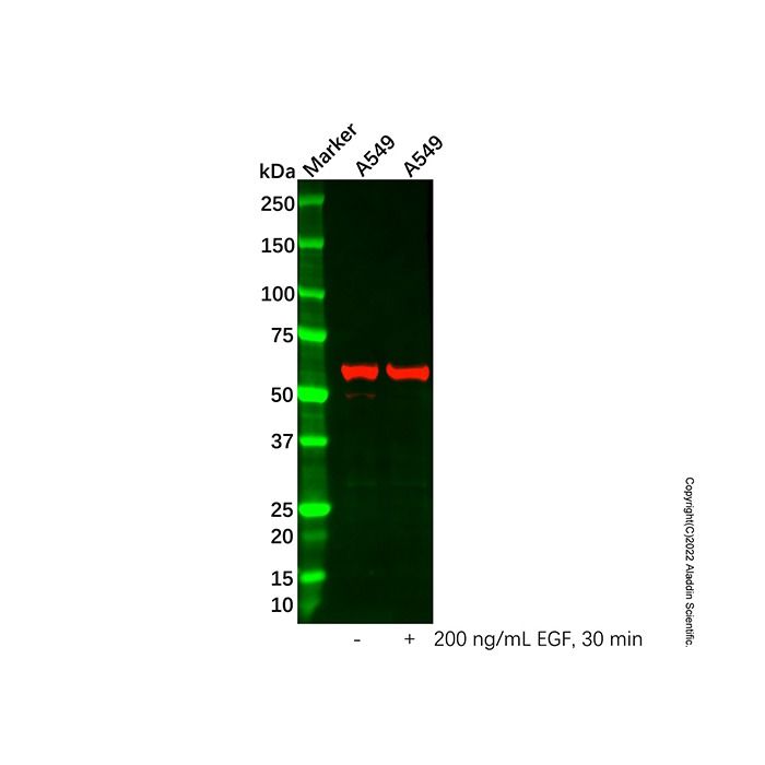 Src (phospho Y529) Antibody -    by Aladdin Scientific