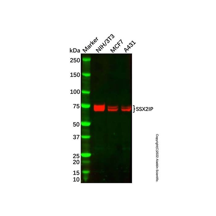 Recombinant SSX2IP Antibody -    by Aladdin Scientific