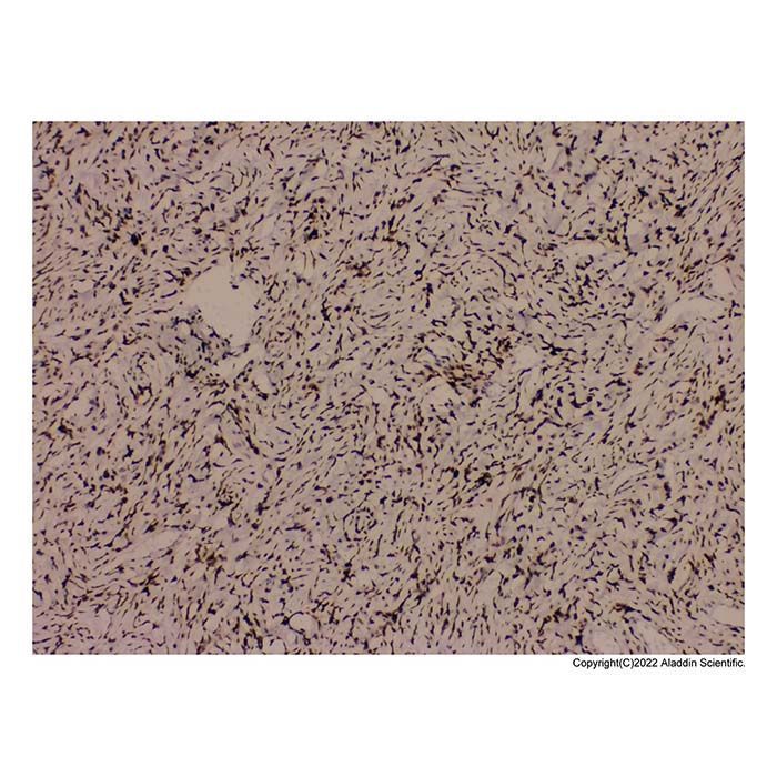 Recombinant STAT6 Antibody -    by Aladdin Scientific