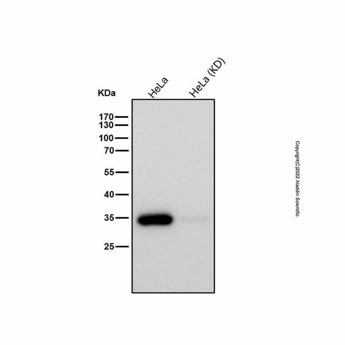 Recombinant STUB1/CHIP Antibody -    by Aladdin Scientific