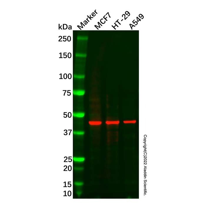 SULT2B1 Mouse mAb -    by Aladdin Scientific