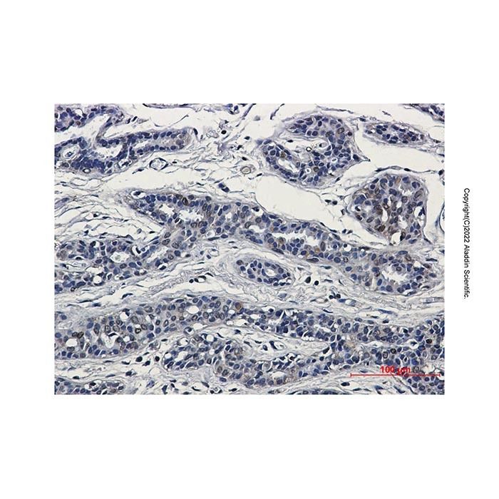 Recombinant SUN1 Antibody -    by Aladdin Scientific