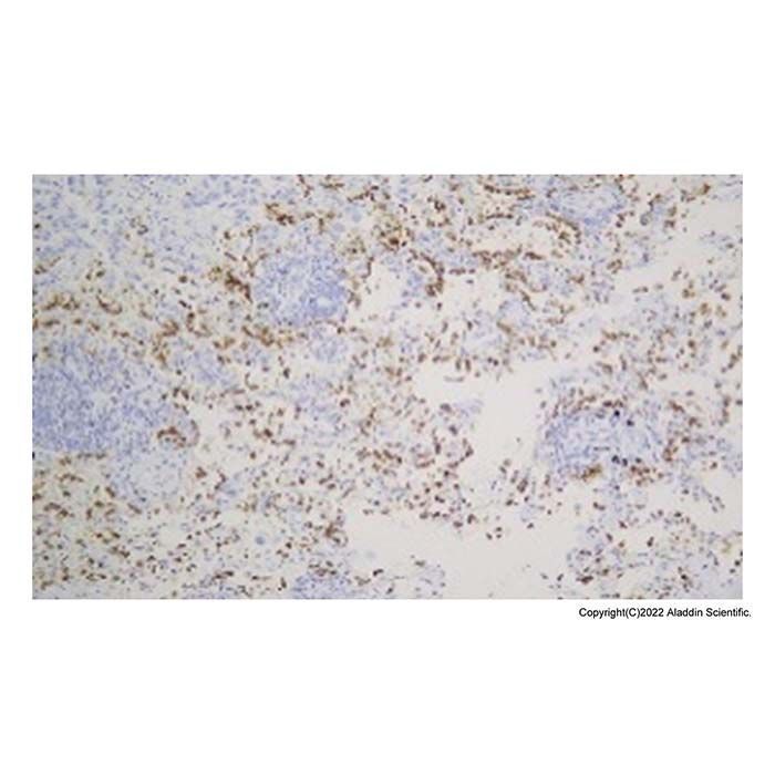 Recombinant Surfactant Protein B Antibody -    by Aladdin Scientific