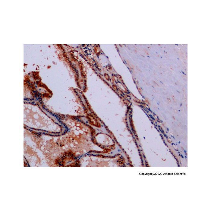 Synaptophysin Antibody -    by Aladdin Scientific