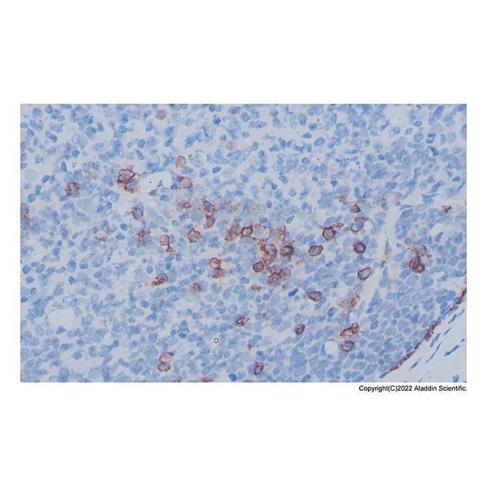 Recombinant Syndecan-1 Antibody -    by Aladdin Scientific
