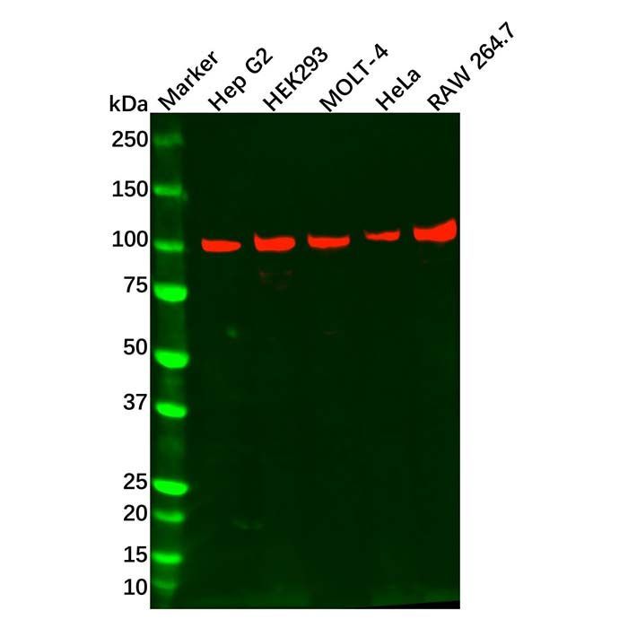Recombinant TAB3 Antibody -    by Aladdin Scientific