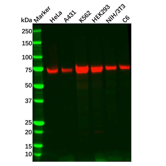 Recombinant TAK1 Antibody -    by Aladdin Scientific
