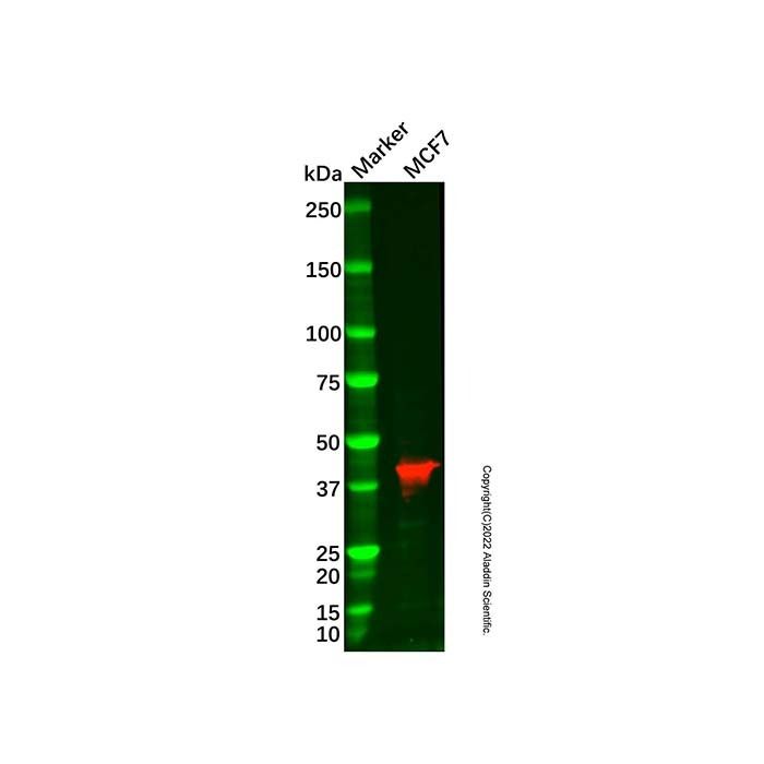 Recombinant TBP Antibody -    by Aladdin Scientific