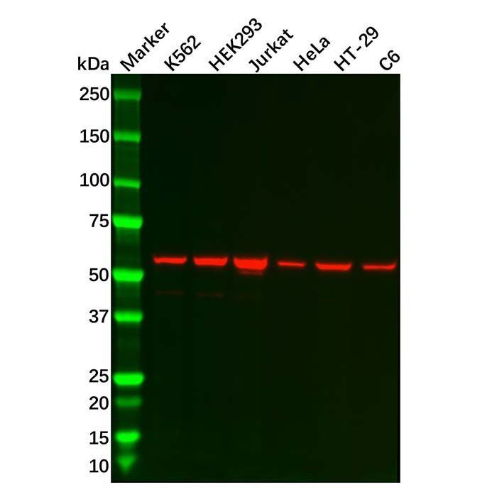Recombinant TBLR1/TBL1XR1 Antibody -    by Aladdin Scientific