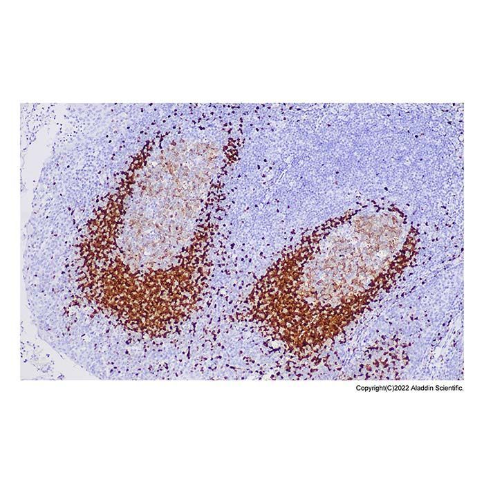 Recombinant Tcl1 Antibody -    by Aladdin Scientific