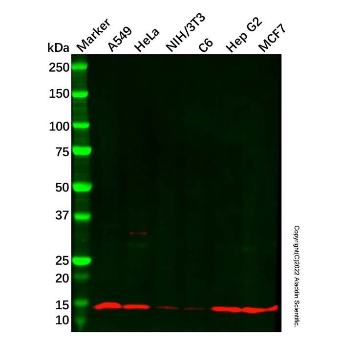 Recombinant TCTEX-1 Antibody -    by Aladdin Scientific