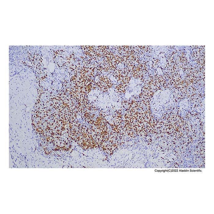 Recombinant TdT Antibody -    by Aladdin Scientific