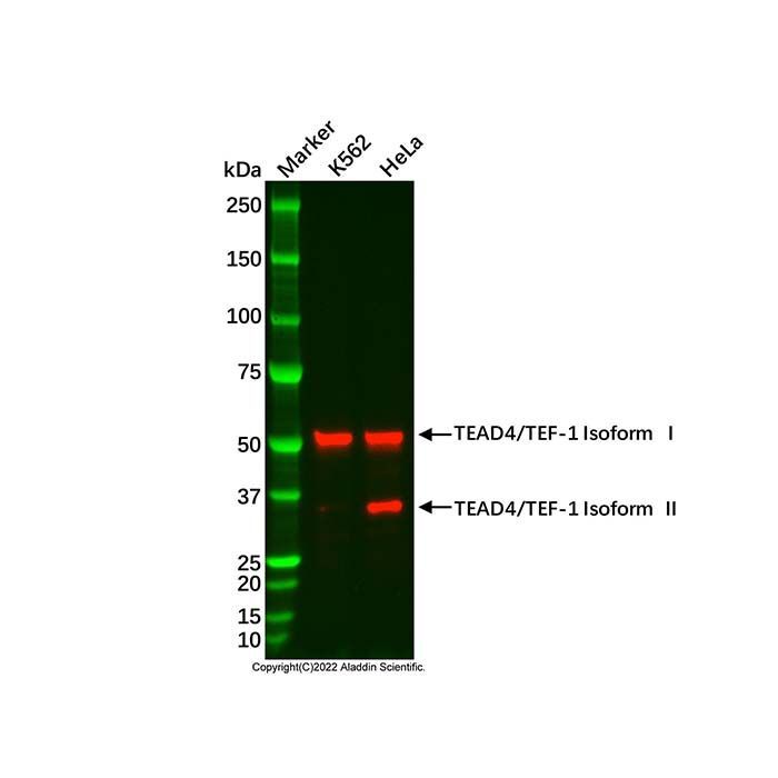 Recombinant TEAD4/TEF-1 Antibody -    by Aladdin Scientific