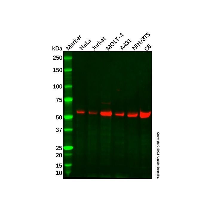 Recombinant TFIIE alpha/GTF2E1 Antibody -    by Aladdin Scientific