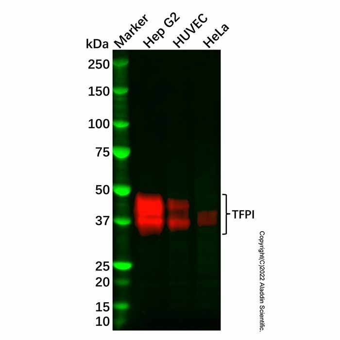 Recombinant TFPI Antibody -    by Aladdin Scientific