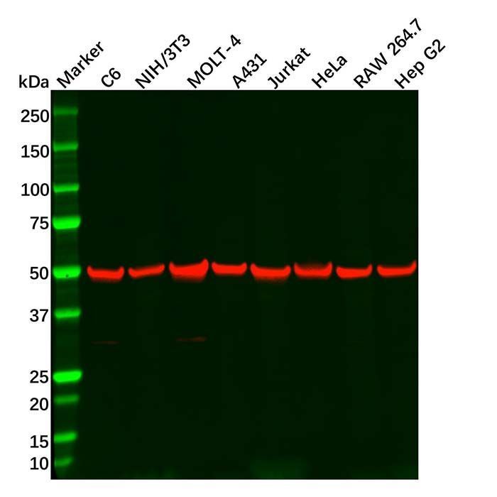 TGF beta Receptor I Antibody -    by Aladdin Scientific