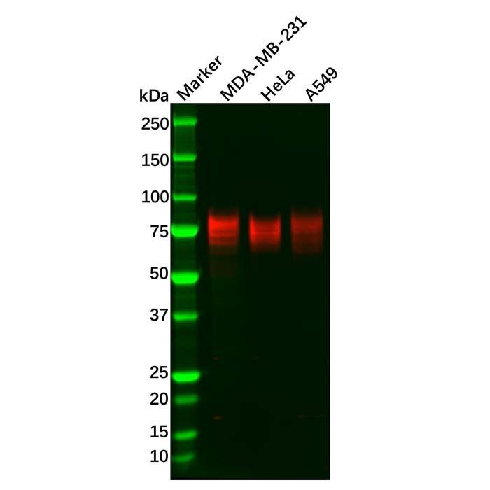 Recombinant TGF beta Receptor II Antibody -    by Aladdin Scientific