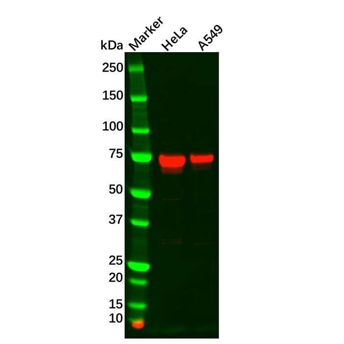 TGFBI Antibody -    by Aladdin Scientific