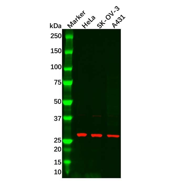 TGIF2 Antibody -    by Aladdin Scientific