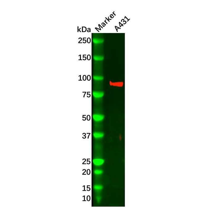 Thrombomodulin Mouse mAb - by Aladdin Scientific