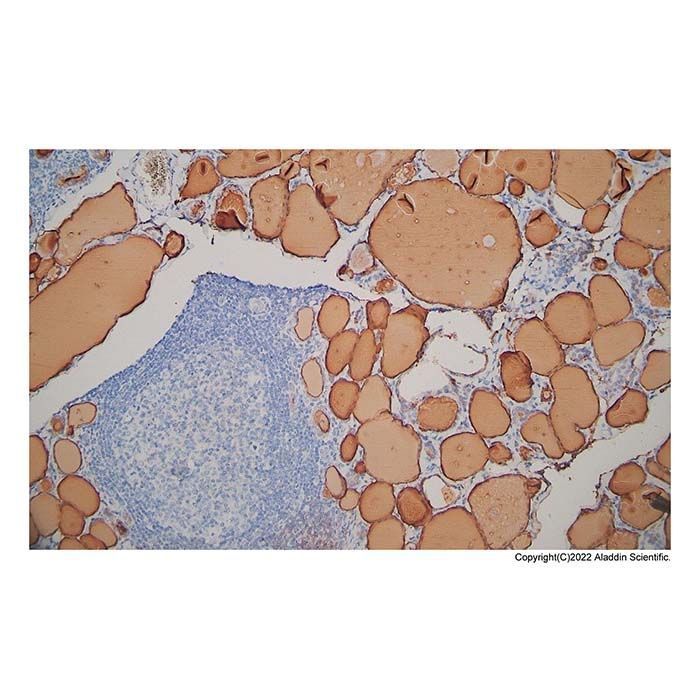 Recombinant Thyroglobulin Antibody -    by Aladdin Scientific
