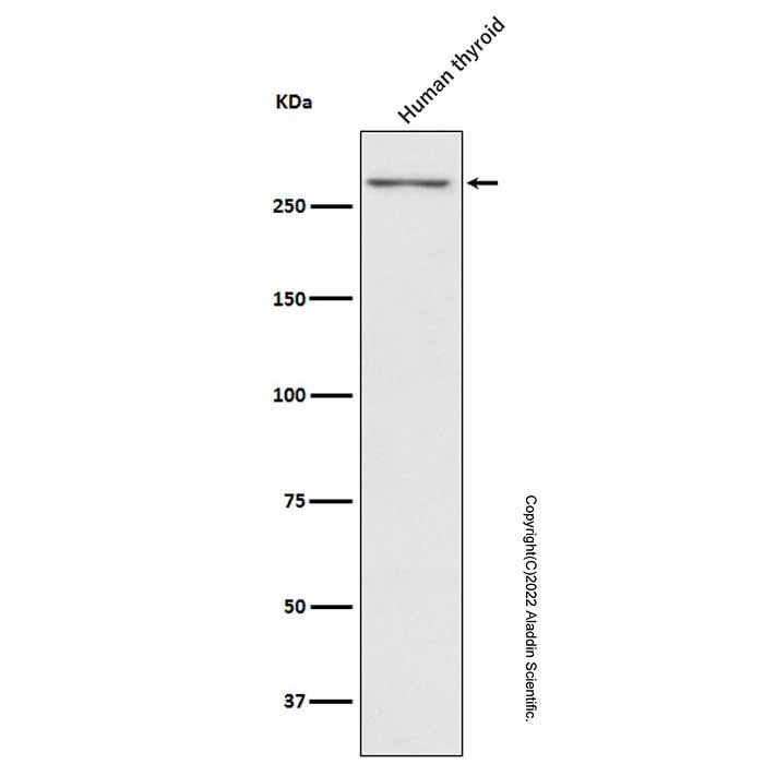 Recombinant Thyroglobulin Antibody -    by Aladdin Scientific
