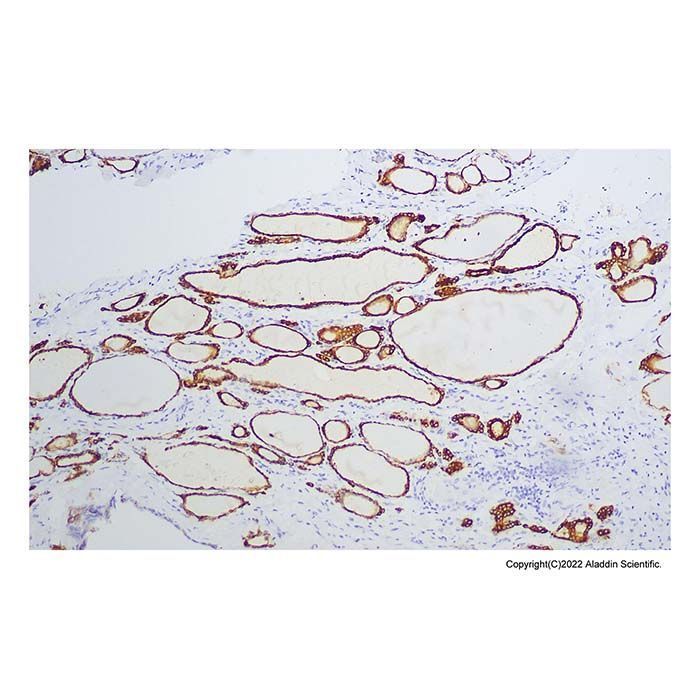 Recombinant Thyroid Peroxidase/TPO Antibody -    by Aladdin Scientific